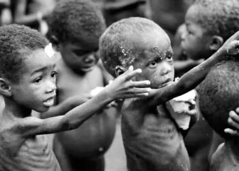 652 Children Fall Victim to Malnutrition in Katsina within 6 Months