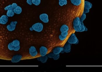 First-Ever Reversal of Type 1 Diabetes Using Stem Cell Therapy