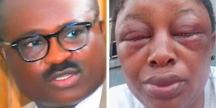 Infidelity Allegation Leads Lawmaker to Violent Clash of Wife